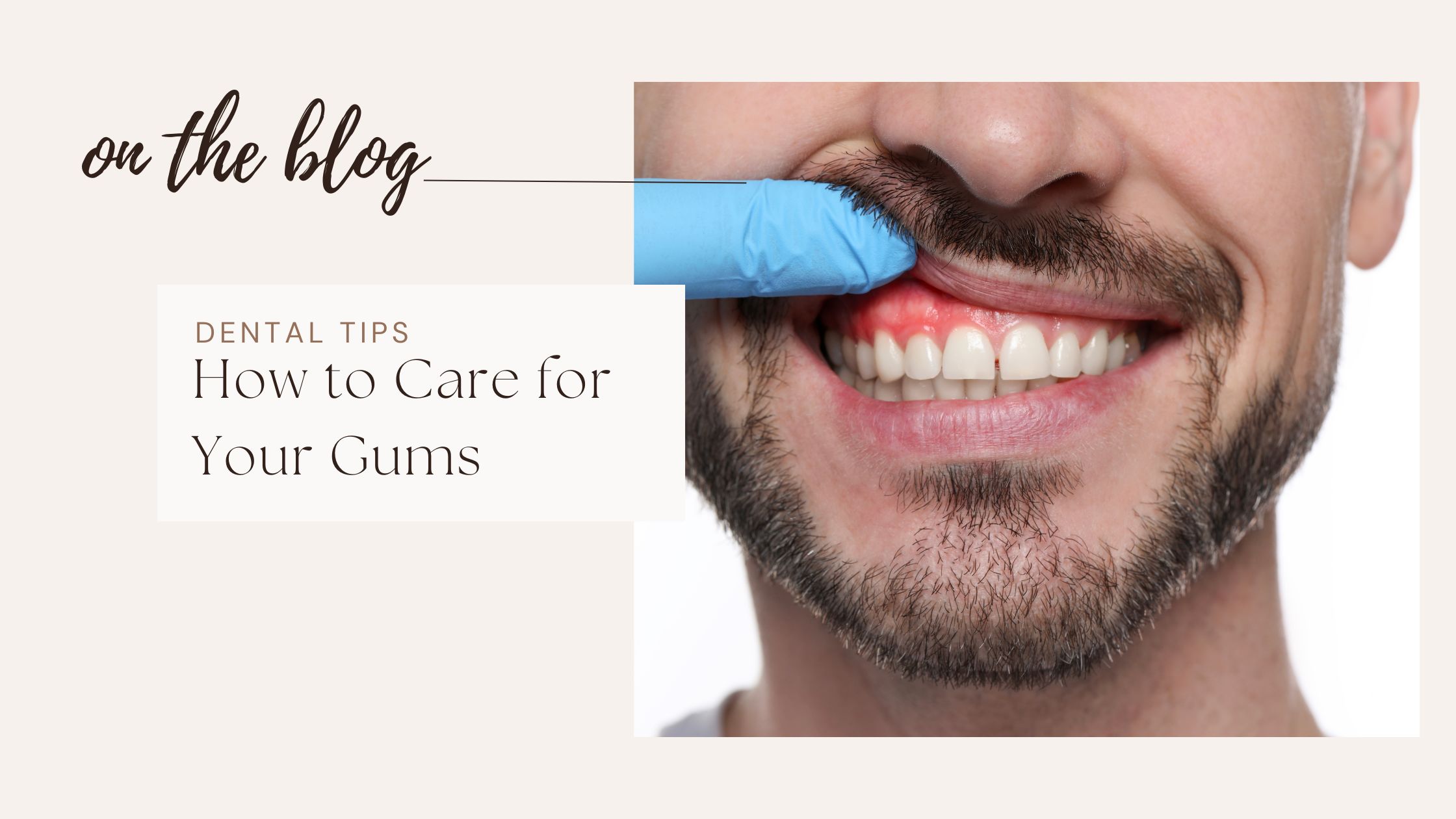 10 Common Dental Problems